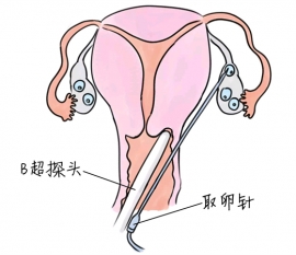 幼儿学画画，上海捐卵宝宝学画画，学画画的好处，如何学画画